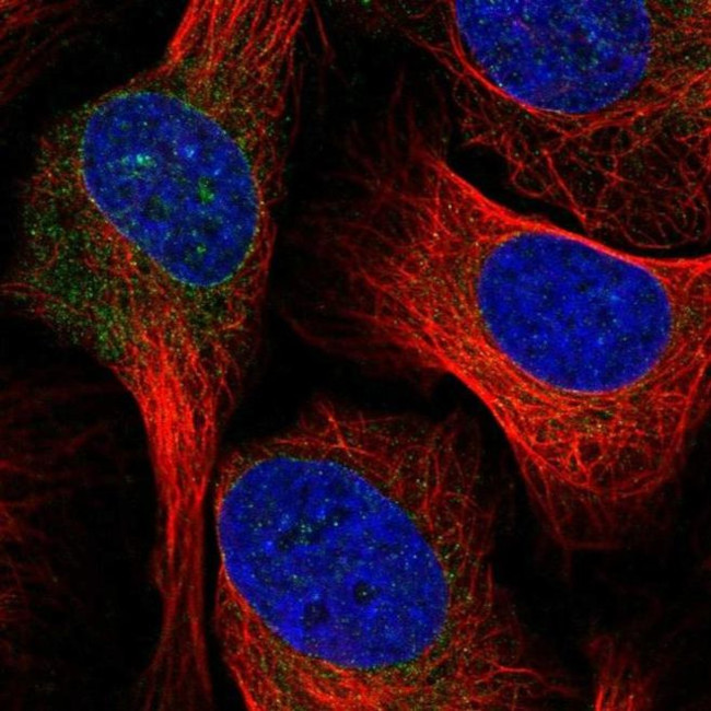 ELOVL1 Antibody in Immunocytochemistry (ICC/IF)