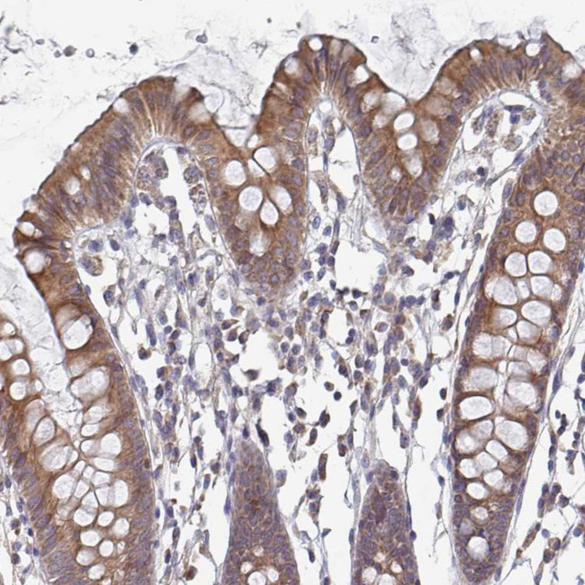 ELOVL1 Antibody in Immunohistochemistry (IHC)