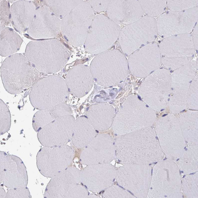 ELOVL1 Antibody in Immunohistochemistry (IHC)