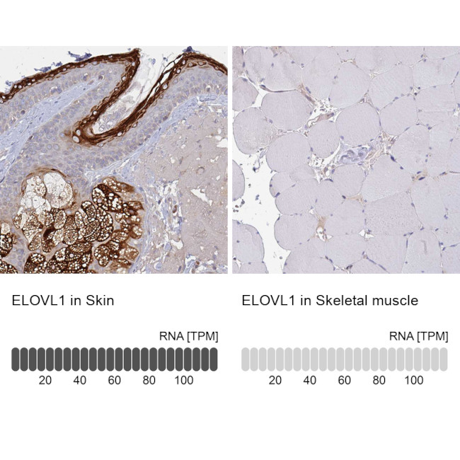 ELOVL1 Antibody