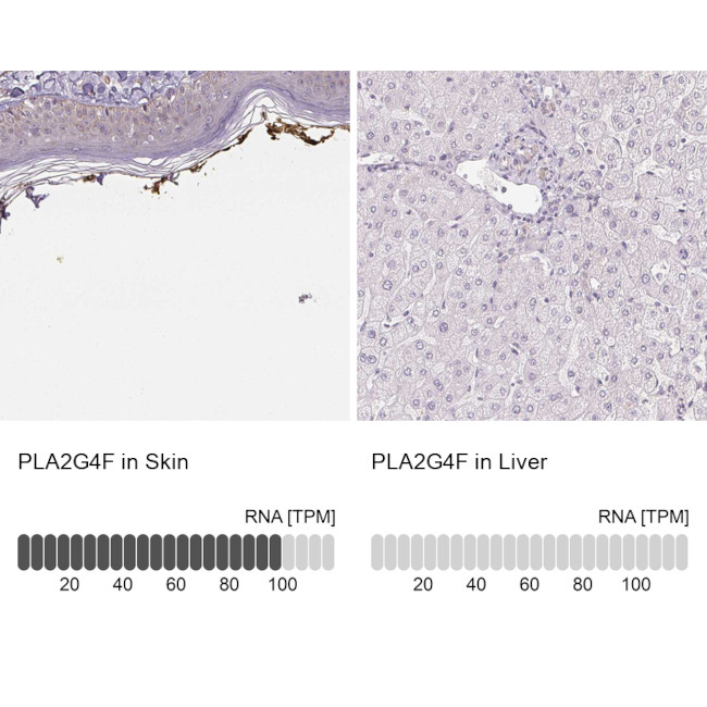 PLA2G4F Antibody in Immunohistochemistry (IHC)