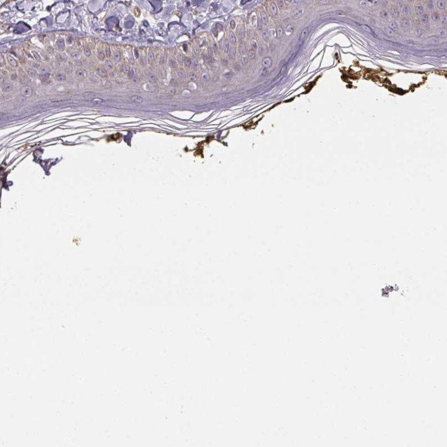 PLA2G4F Antibody in Immunohistochemistry (IHC)