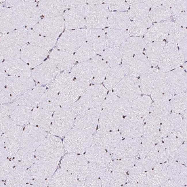 SAM68 Antibody in Immunohistochemistry (IHC)