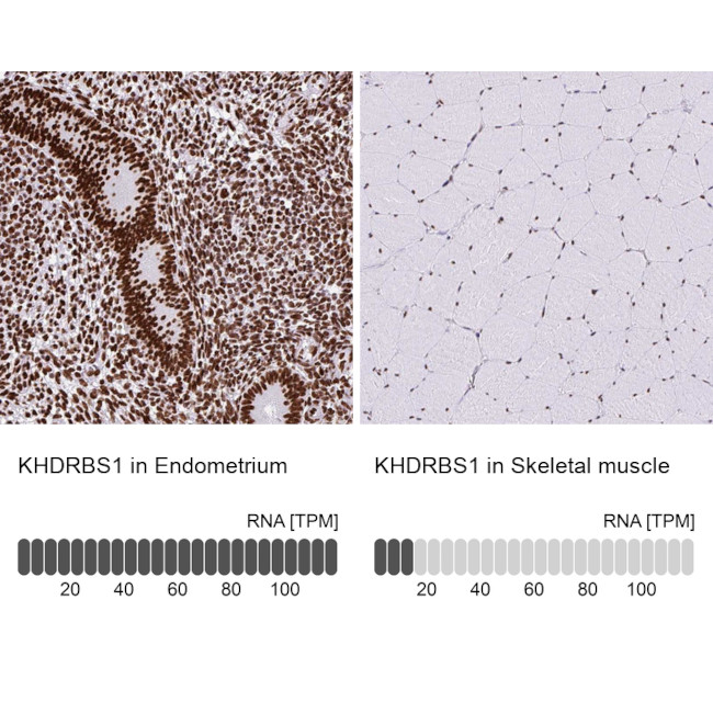 SAM68 Antibody