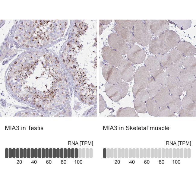 MIA3 Antibody in Immunohistochemistry (IHC)