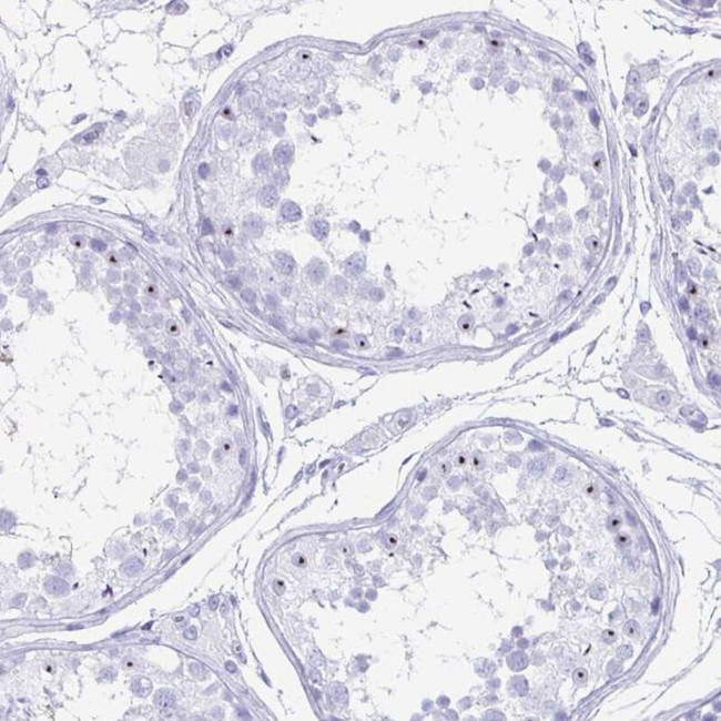 C12orf56 Antibody in Immunohistochemistry (IHC)