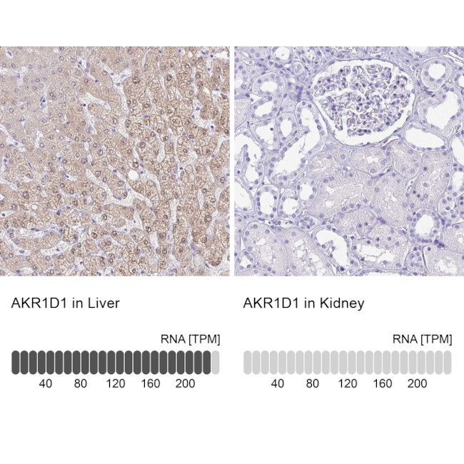 AKR1D1 Antibody in Immunohistochemistry (IHC)