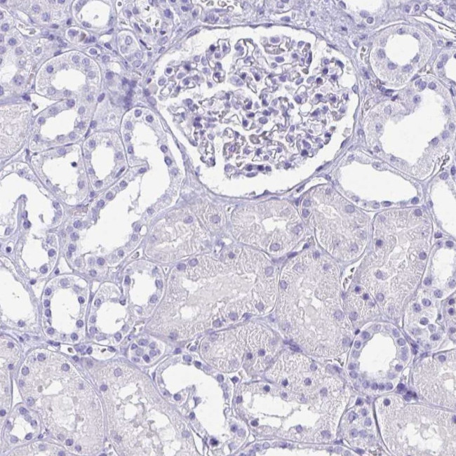 AKR1D1 Antibody in Immunohistochemistry (IHC)