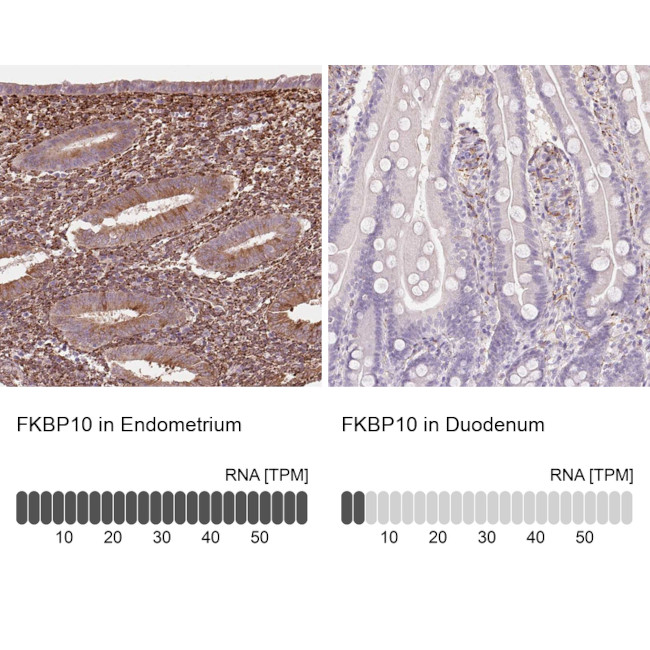 FKBP10 Antibody in Immunohistochemistry (IHC)