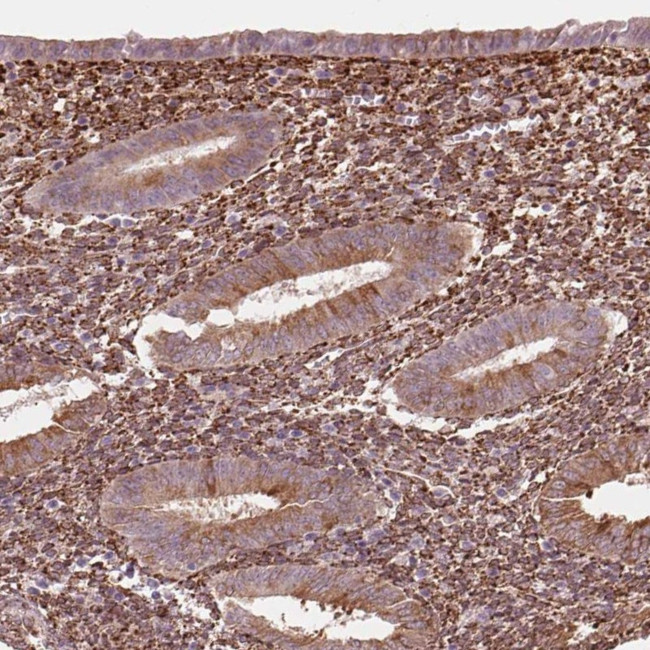 FKBP10 Antibody in Immunohistochemistry (IHC)