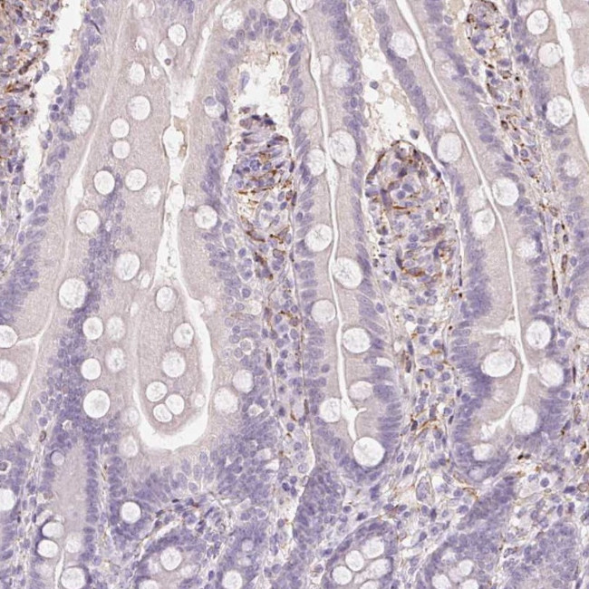 FKBP10 Antibody in Immunohistochemistry (IHC)