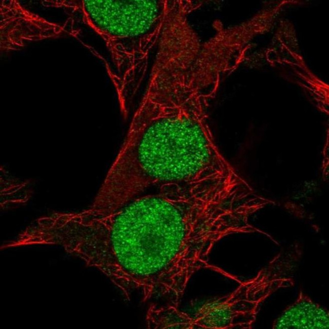 DHRS12 Antibody in Immunocytochemistry (ICC/IF)