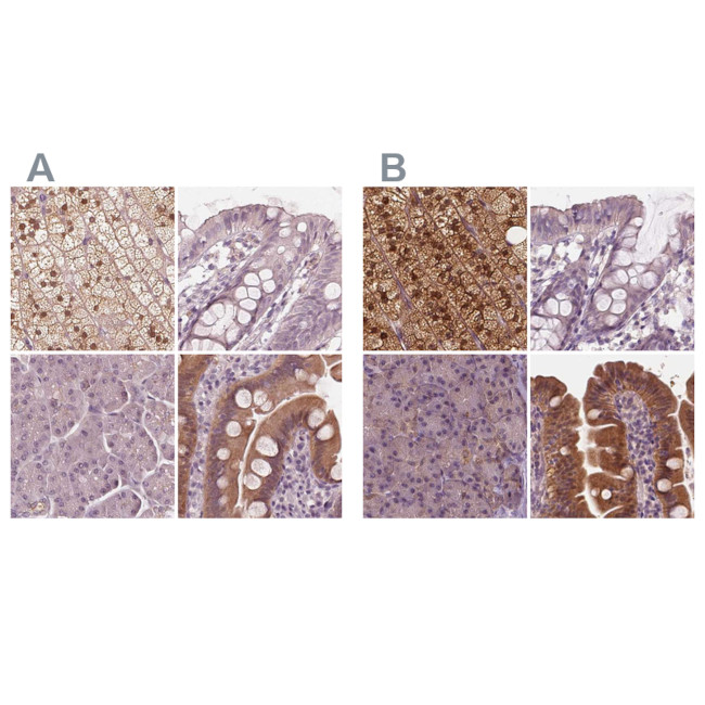 SAT2 Antibody in Immunohistochemistry (IHC)