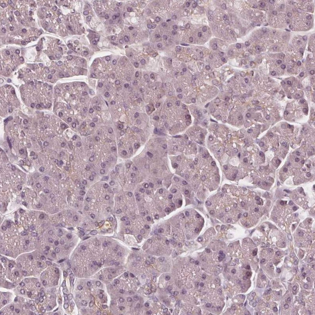 SAT2 Antibody in Immunohistochemistry (IHC)