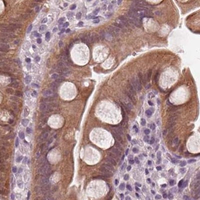 SAT2 Antibody in Immunohistochemistry (IHC)