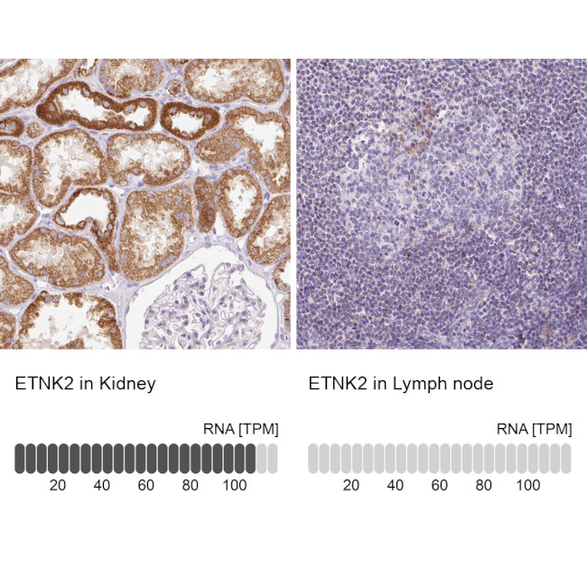 ETNK2 Antibody