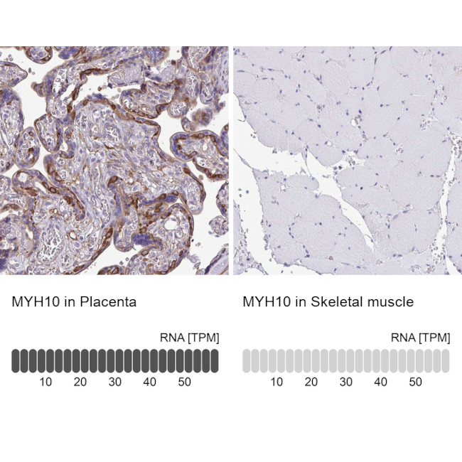 MYH10 Antibody in Immunohistochemistry (IHC)