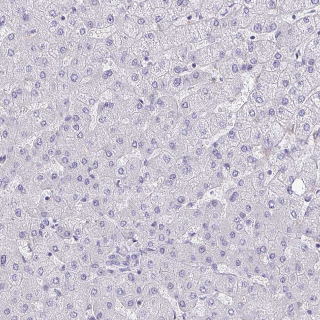 Adenylate Kinase 5 Antibody in Immunohistochemistry (IHC)