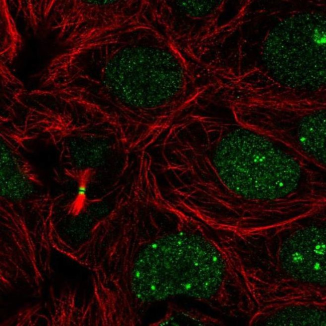 RBM18 Antibody in Immunocytochemistry (ICC/IF)