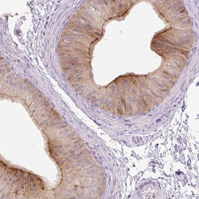 VPS25 Antibody in Immunohistochemistry (IHC)