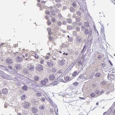 V-ATPase D Antibody in Immunohistochemistry (IHC)