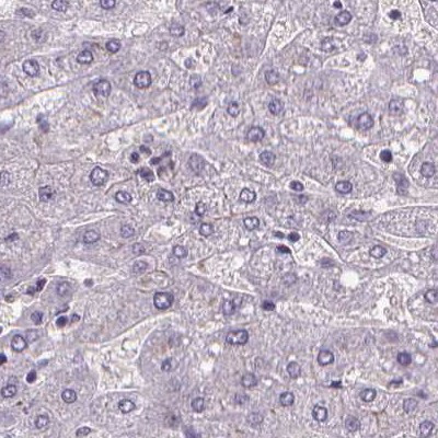 V-ATPase D Antibody in Immunohistochemistry (IHC)