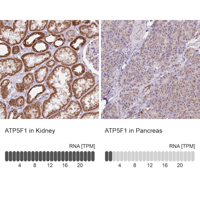 ATP Synthase B1 Antibody in Immunohistochemistry (IHC)