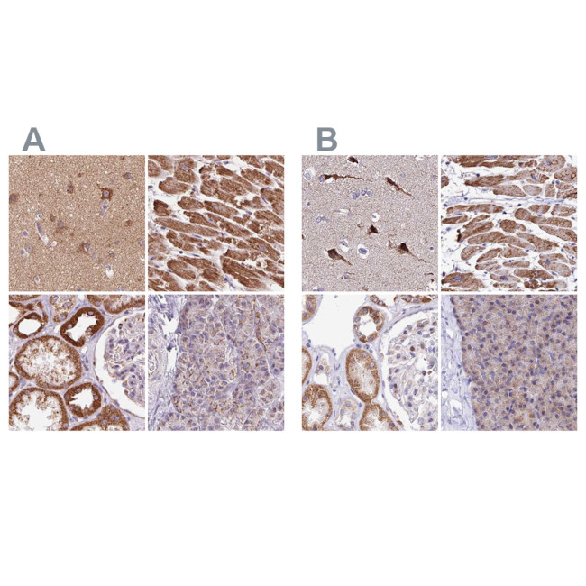 ATP Synthase B1 Antibody in Immunohistochemistry (IHC)