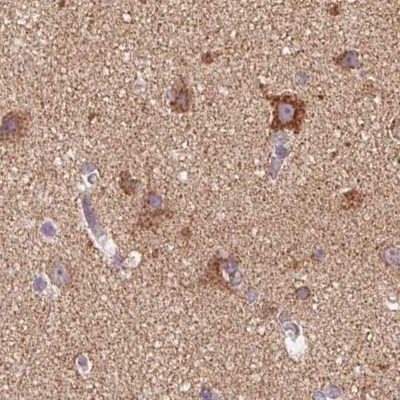 ATP Synthase B1 Antibody in Immunohistochemistry (IHC)