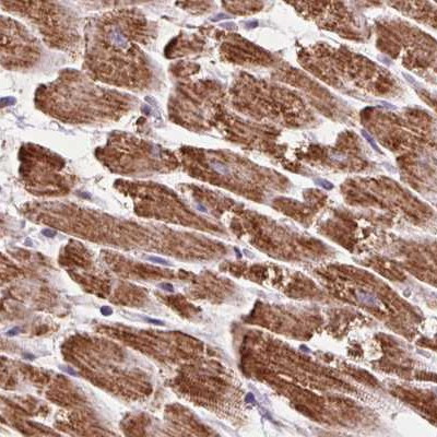 ATP Synthase B1 Antibody in Immunohistochemistry (IHC)