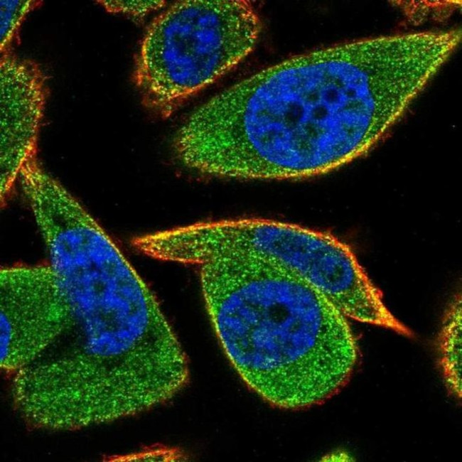 RAB5IF Antibody in Immunocytochemistry (ICC/IF)