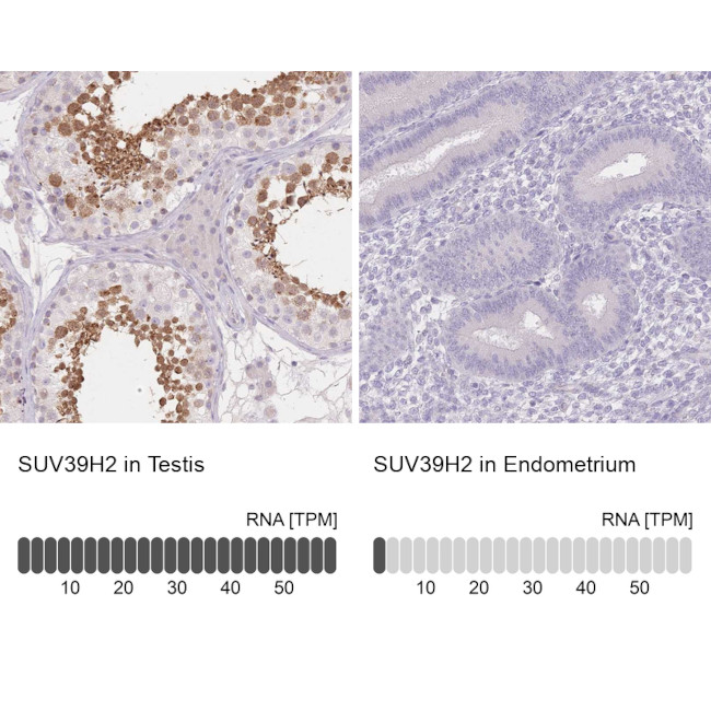 SUV39H2 Antibody in Immunohistochemistry (IHC)