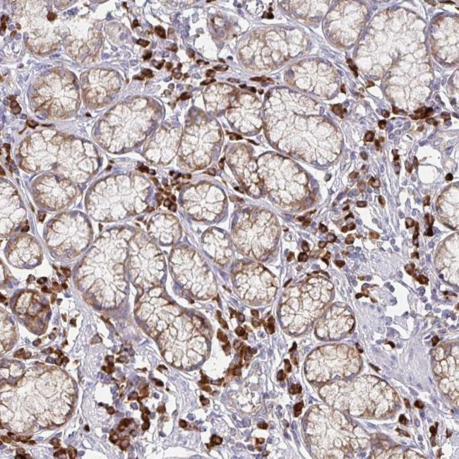 YARS2 Antibody in Immunohistochemistry (IHC)