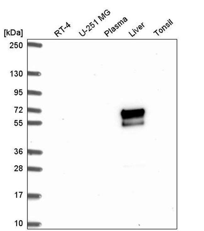 ACSM2A Antibody in Western Blot (WB)