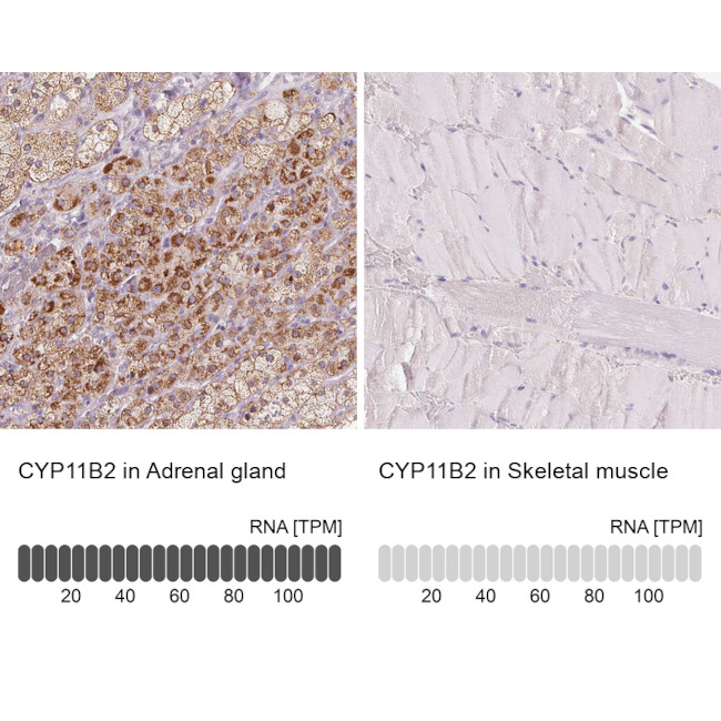 CYP11B2 Antibody