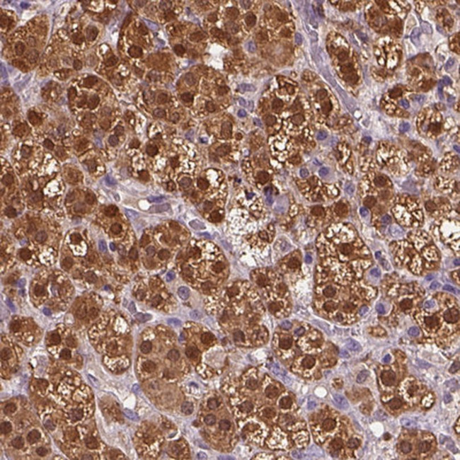 CYP11B2 Antibody in Immunohistochemistry (IHC)