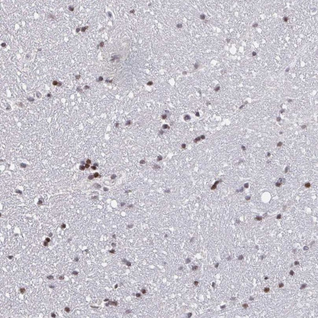 PCDHB8 Antibody in Immunohistochemistry (IHC)