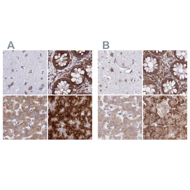 RPS15 Antibody in Immunohistochemistry (IHC)