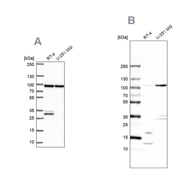 WDR48 Antibody in Western Blot (WB)