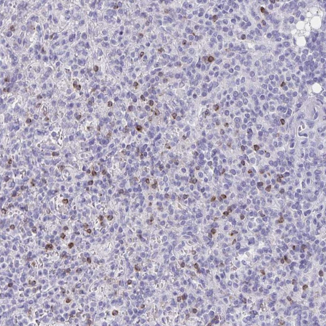 Granulysin Antibody in Immunohistochemistry (IHC)