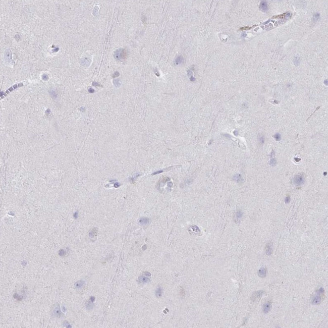 Granulysin Antibody in Immunohistochemistry (IHC)