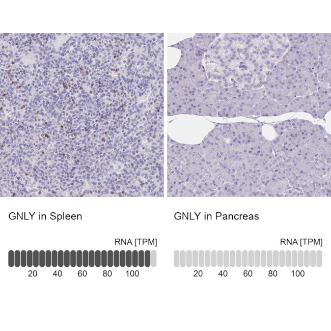 Granulysin Antibody