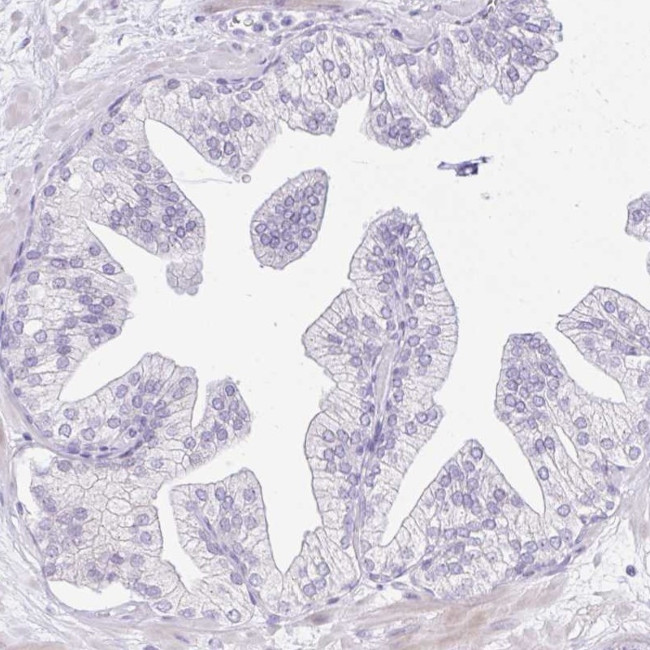 REEP1 Antibody in Immunohistochemistry (IHC)