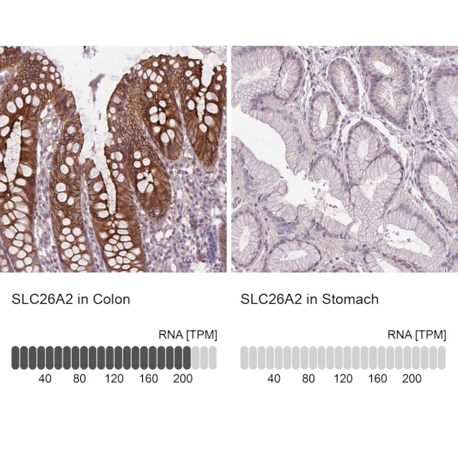 SLC26A2 Antibody