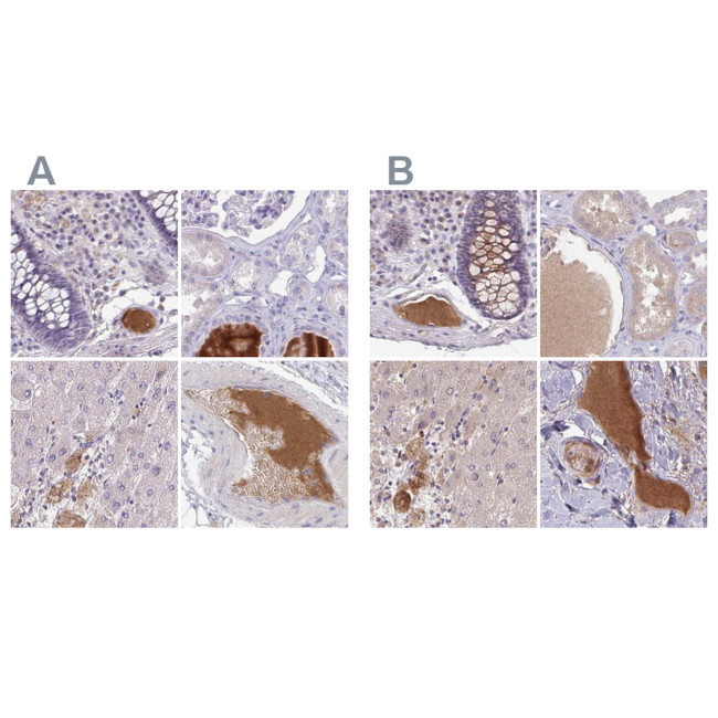 HGF Activator Antibody in Immunohistochemistry (IHC)