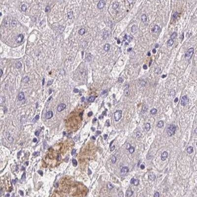 HGF Activator Antibody in Immunohistochemistry (IHC)