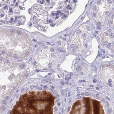 HGF Activator Antibody in Immunohistochemistry (IHC)