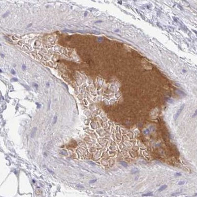 HGF Activator Antibody in Immunohistochemistry (IHC)