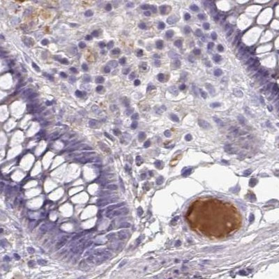 HGF Activator Antibody in Immunohistochemistry (IHC)