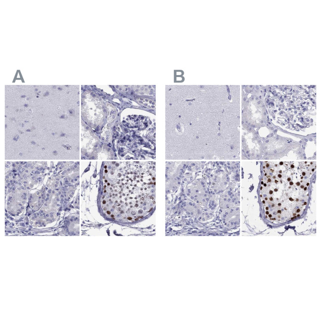 STAG3 Antibody in Immunohistochemistry (IHC)